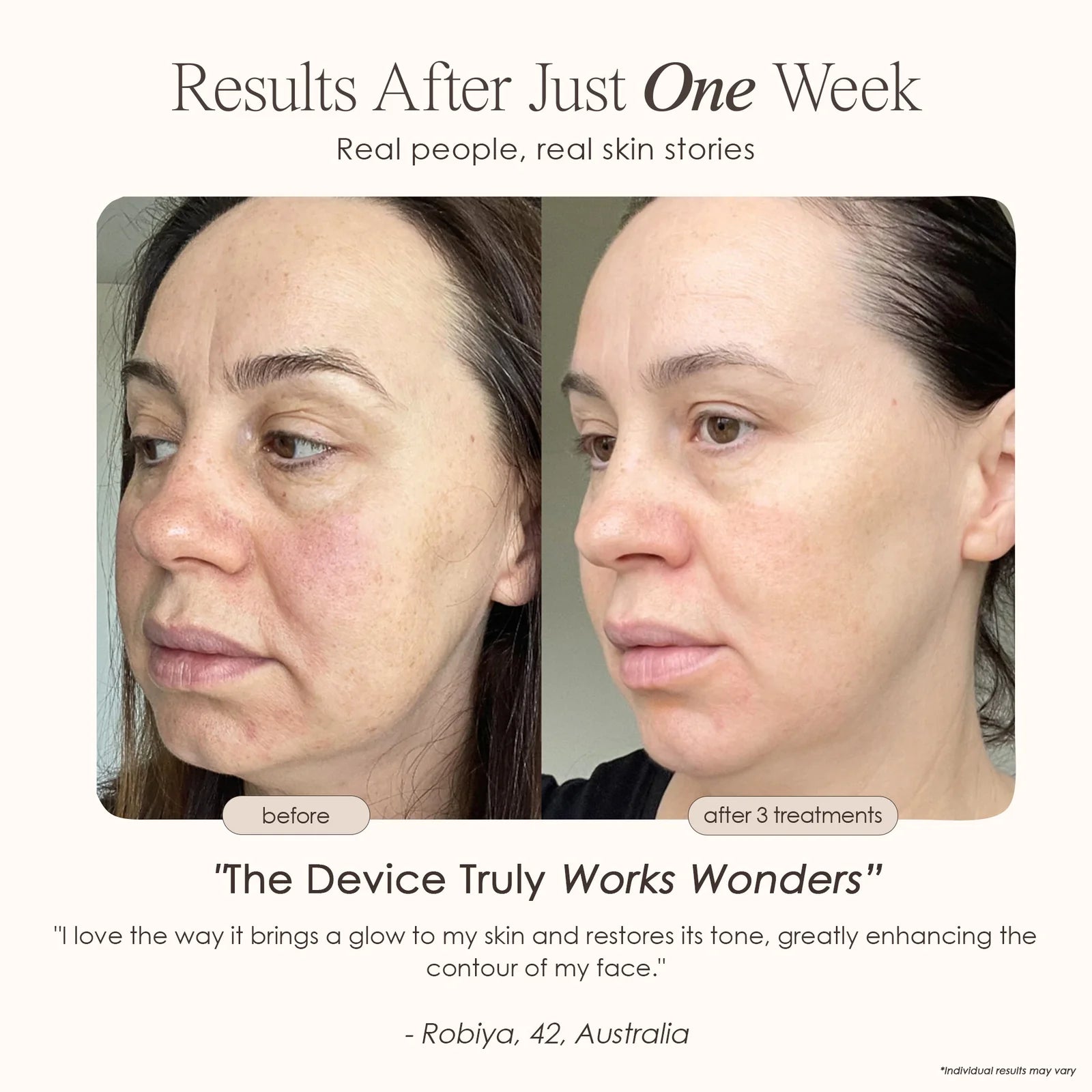 Instant Age Renewal Wand