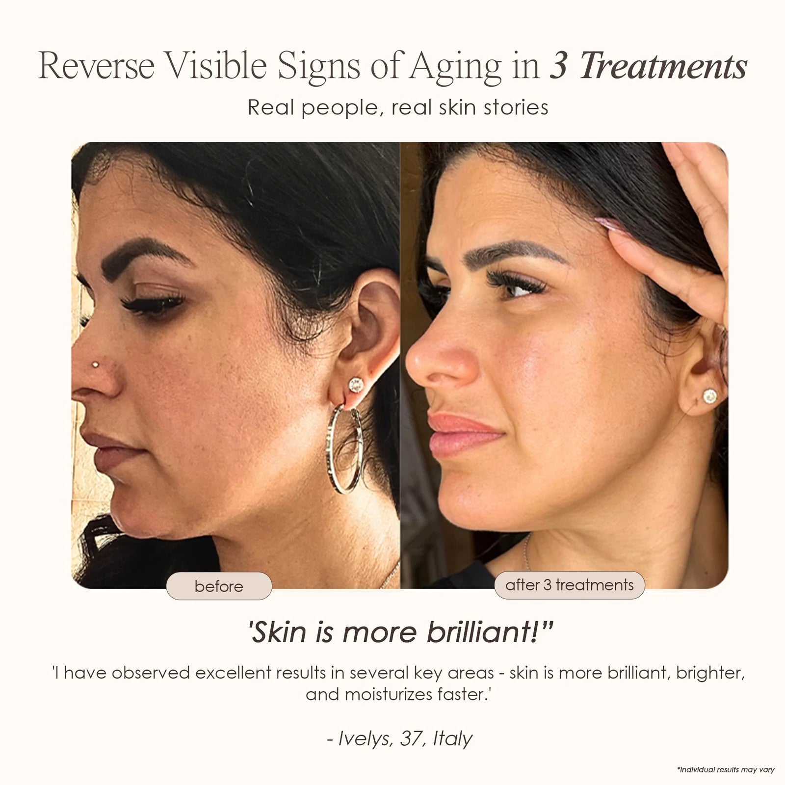 Instant Age Renewal Wand